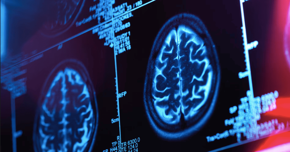 المرض الغامض في كندا